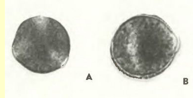 Таволга вязолистная, или лабазник (Filipendula ulmaria Maxim.)-пыльцевые зерна