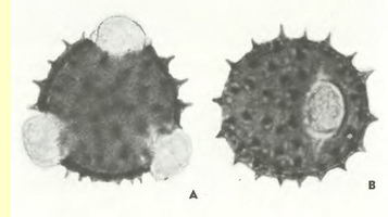 Мать-и-мачеха обыкновенная (Tussilago farfara L.)-пыльцевые зерна