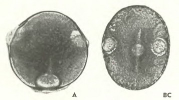 Горошек мышиный (Vicia cracca L)-пыльцевые зерна