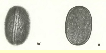 Ёспарцет посевной (Onobrychis sativa L.)-пыльцевые зерна